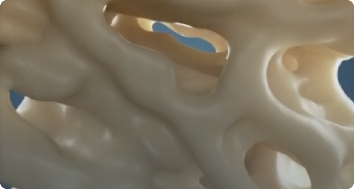 Hueso normal comparado con hueso con osteoporosis