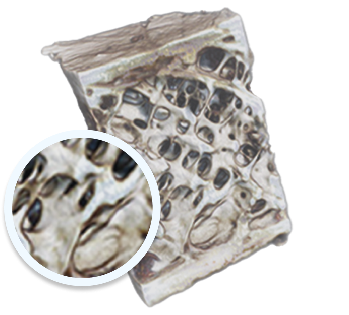 Hueso osteoporótico sin tratar vs. hueso osteoporótico tratado con EVENITY® (romosozumab-aqqg)